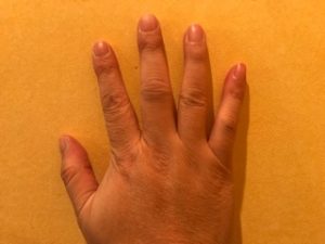 右手中指の関節